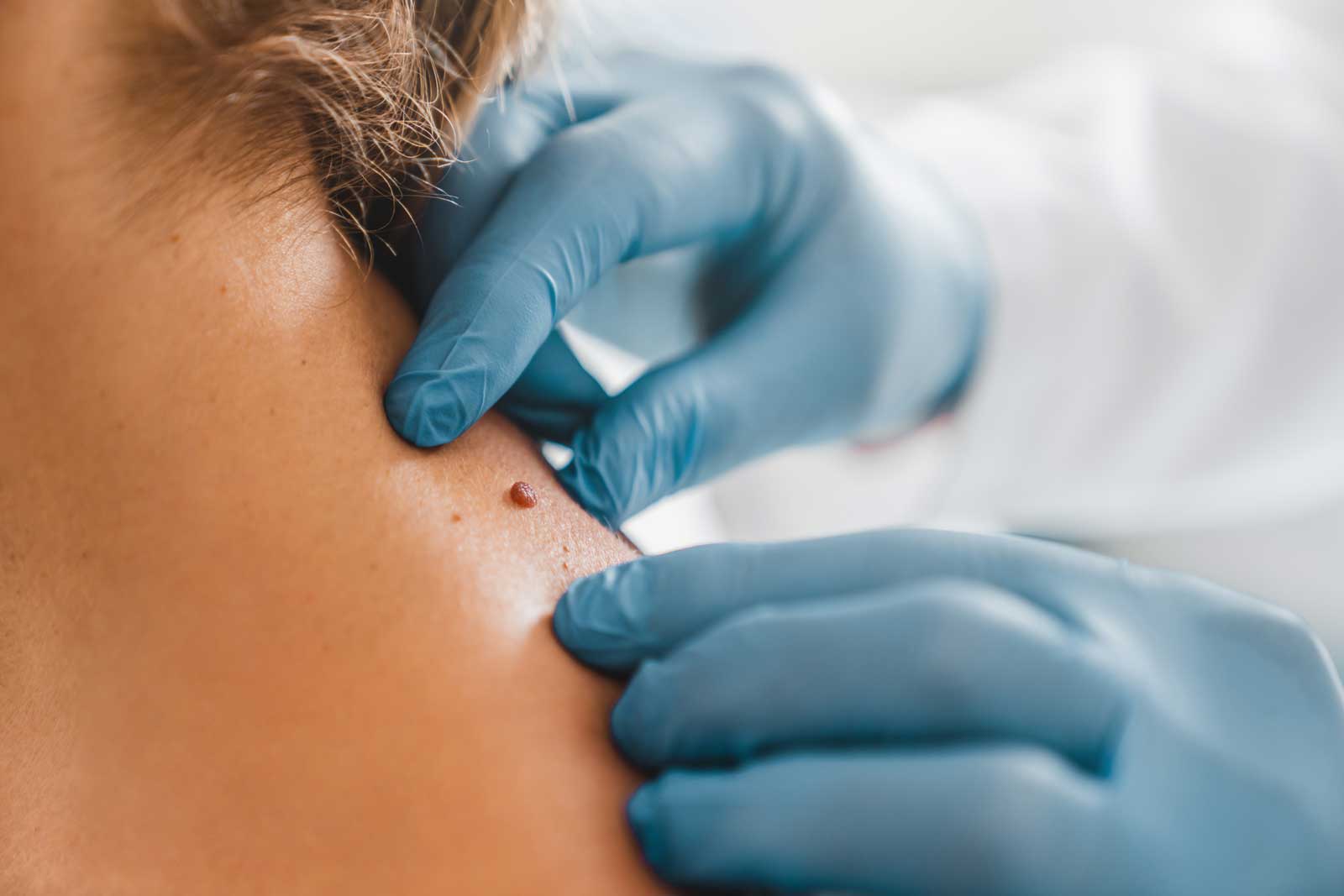 The-Importance-of-Regular-Skin-Checks