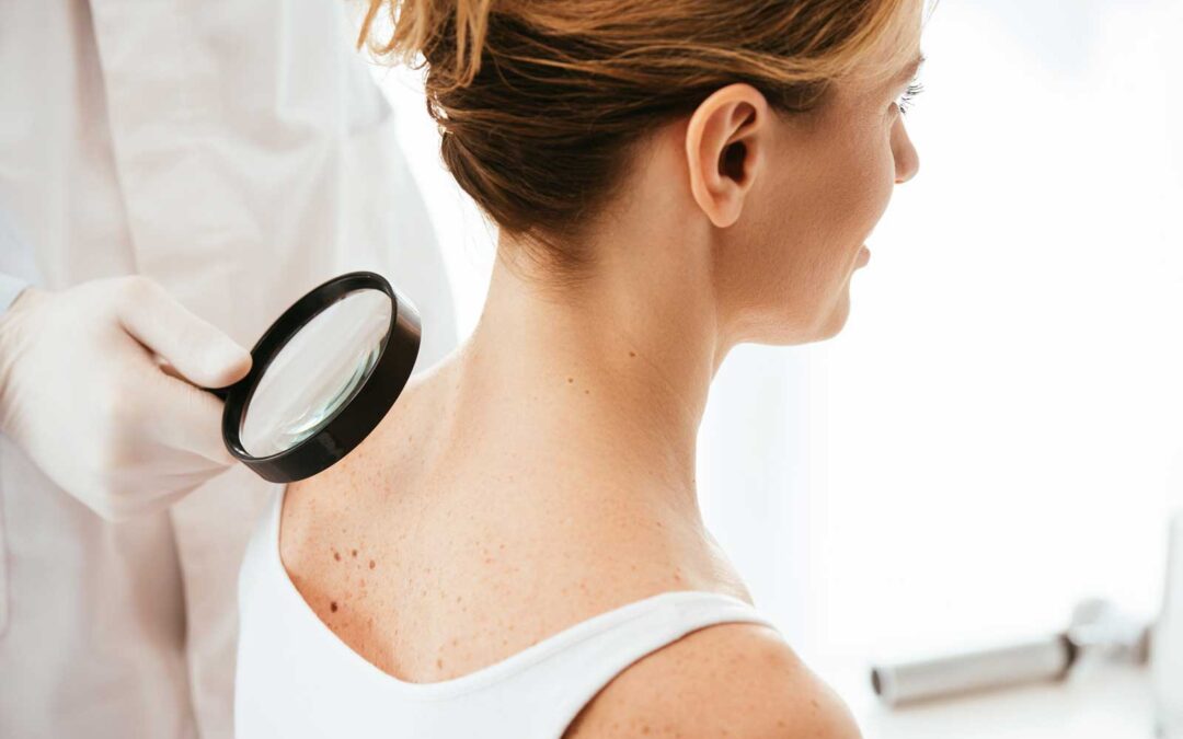 Understanding Different Types of Skin Cancer: What You Need to Know